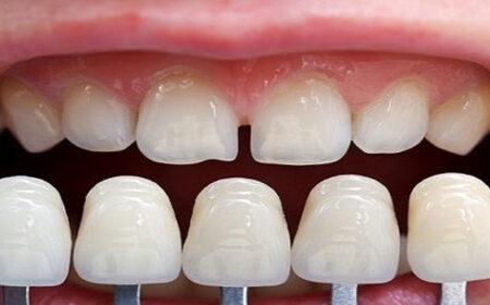 2c8364707294ce389bdf4abb7de61c0b