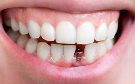 75af1587fa7f2d2f4cd83be9246e8670